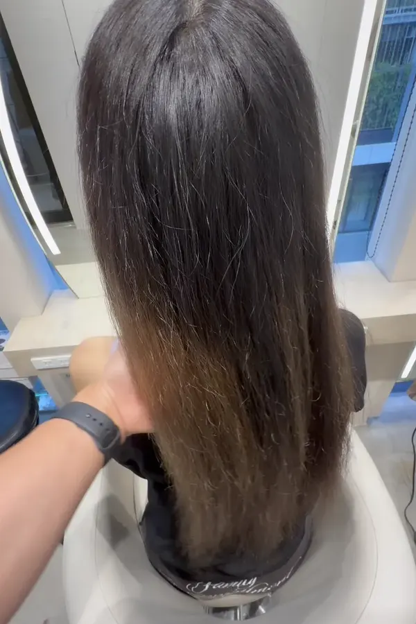 CASE 02 施術前(Before)